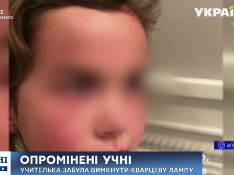 Опіки очей і шкіри: 25 першокласників московської школи потрапили лікарню (ВІДЕО)