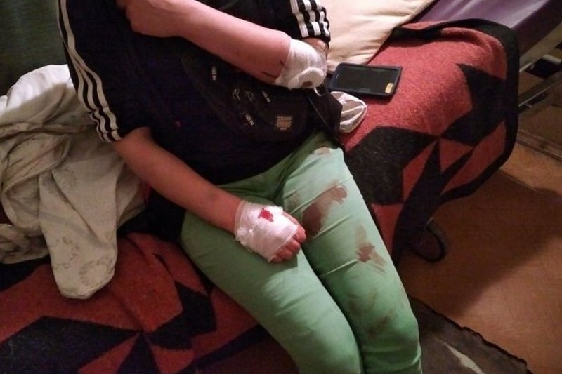 Дика жорстокість струсонула українських батьків: скалічили дитину заради задоволення - 