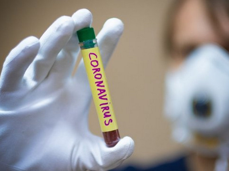 В Україні за добу коронавірус знайшли ще у 343 людей