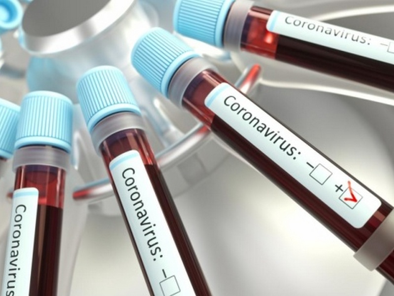 В Україні зафіксували 4161 випадок коронавірусу