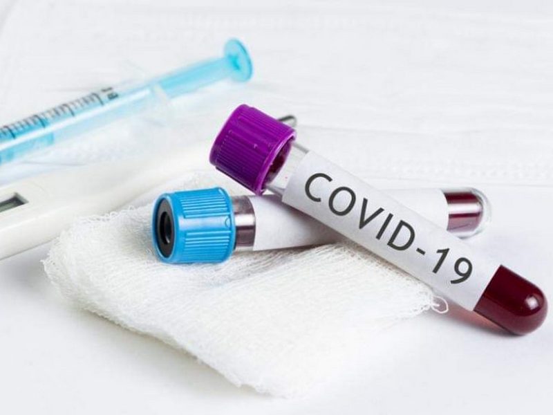 Кількість заражень COVID-19 у світі зменшується