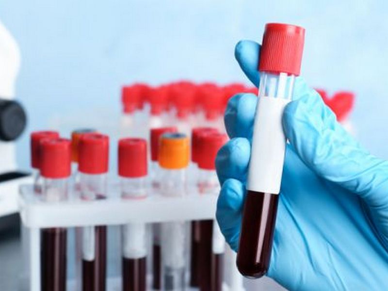 У двох областях України запускають тестування на антитіла до коронавірусу — Ляшко