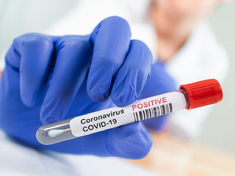 У Росії за добу від коронавірусу померла рекордна кількість людей – 232