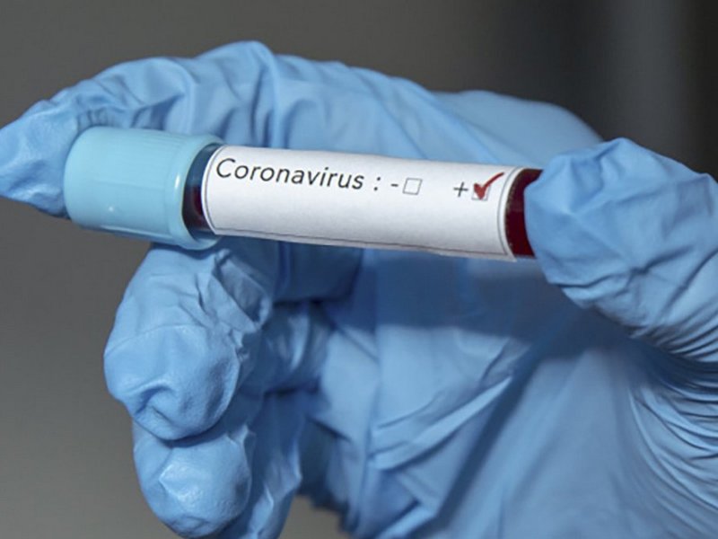 Пандемія COVID-19 в Україні повільно згасатиме до кінця червня, – науковці