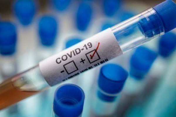 В Україні за добу від коронавірусу померли 13 осіб