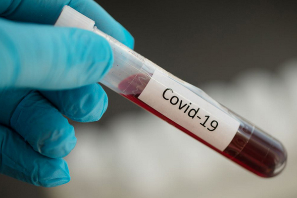 В Україні за добу виявили 5 804 нові випадки коронавірусу