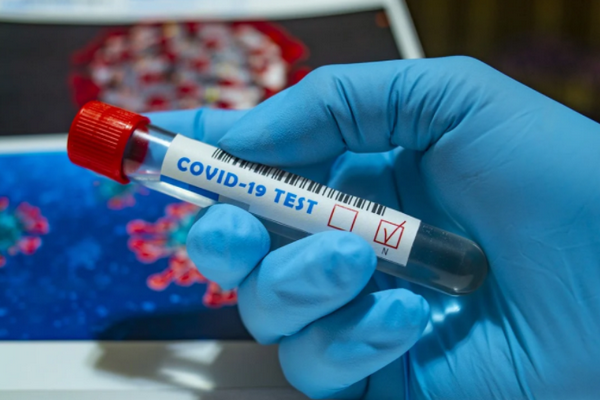 У Європі кожні 17 секунд від коронавірусу помирає одна людина – ВООЗ