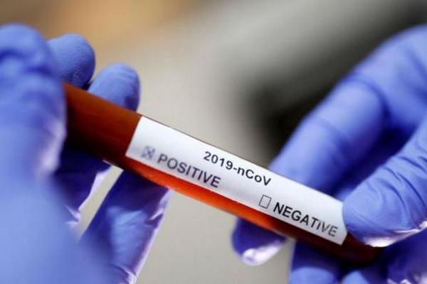 Черговий рекорд в Україні: за добу на коронавірус захворіли 12 524 людини