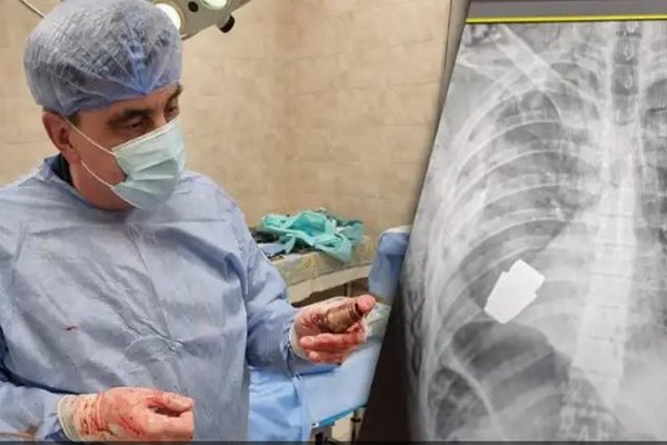 Українські лікарі – неперевершені: з тіла військового видалили гранату, що не розірвалася