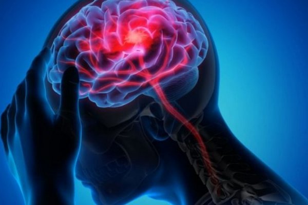 Вчені дізналися, чи є зв’язок між інсультом і зростом людини