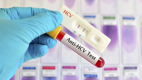 «Тест руйнує страх»: Закарпаття долучається до всеукраїнського тижня обстеження на вірусні гепатити В і С