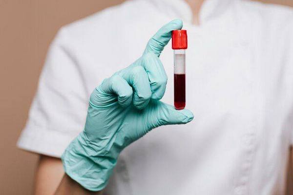 Развернутый анализ крови: основные показатели